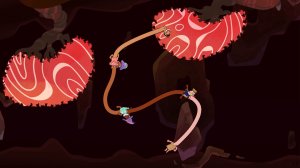 Screenshot #1 - Esophaguys